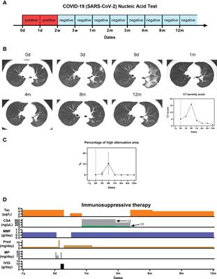 Long-Term Clinical and Immunological Impact of Severe COVID-19 on a Living Kidney Transplant Recipient – A Case Report